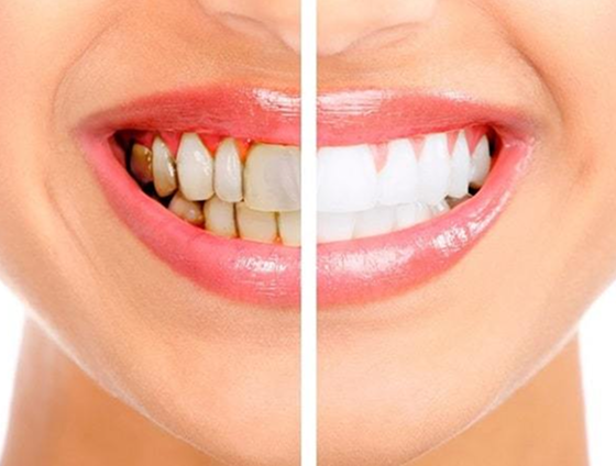 Before transformation